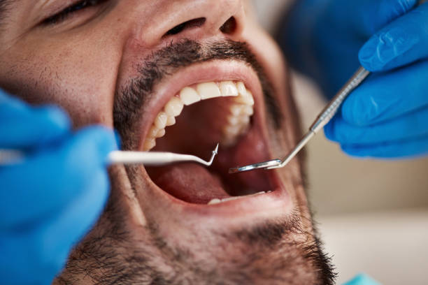 Best Emergency Cosmetic Dentistry in West Rson, CA